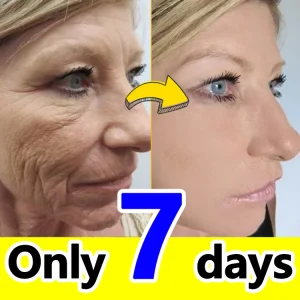 20 Years Younger Anti-Wrinkle Serum – Advanced Formula for Smooth, Youthful Skin